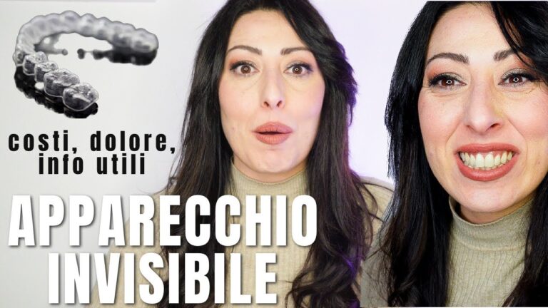 Recensioni sull’Apparecchio Trasparente: Vantaggi e Opinioni