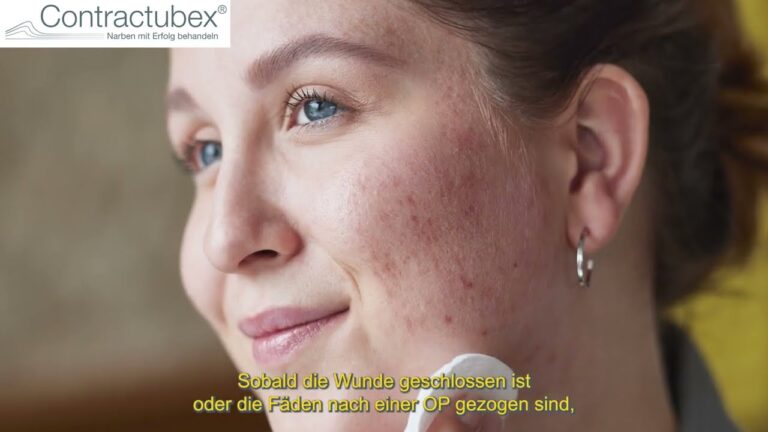 Prezzo di Contractubex Crema: Tutto Quello che Devi Sapere