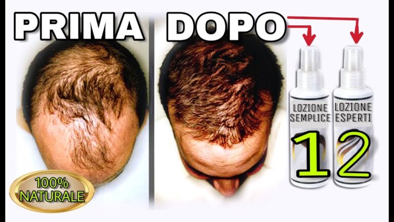 Klorane Shampoo Anticaduta: Recensioni e Opinioni Utili