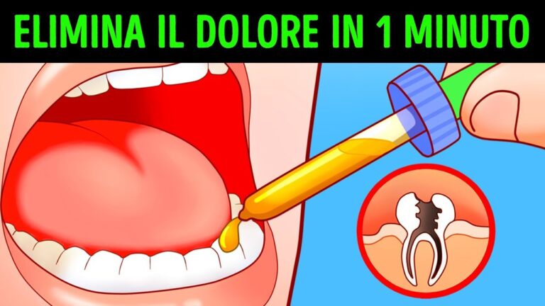 Oki per il Dente del Giudizio: Sollievo Efficace dal Dolore