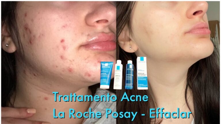 Effaclar di La Roche-Posay: Recensioni e Opinioni