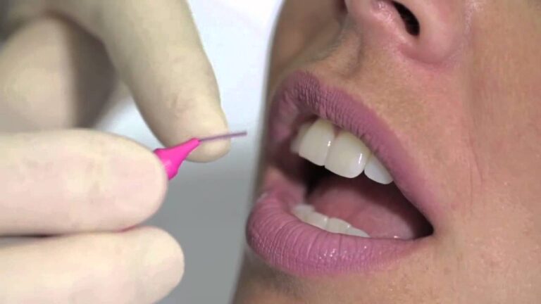 Scopri Dentalux Filo Interdentale: Efficacia e Benefici per la Tua Igiene Orale