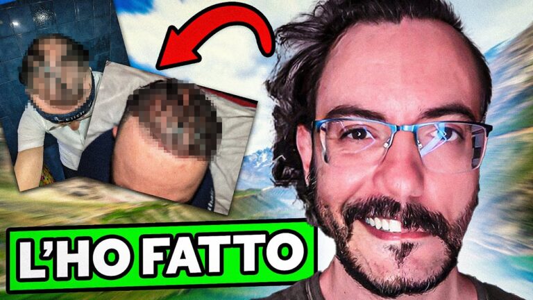 Trapianto di Capelli in Turchia: Analisi delle Recensioni Negative