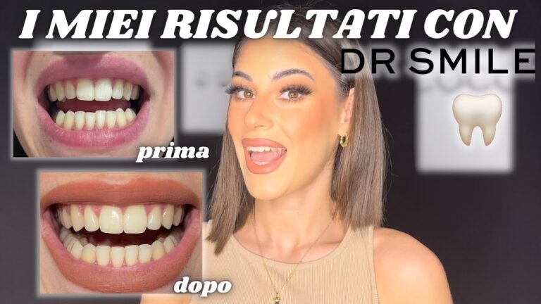 Dr. Smile: Funziona Davvero?
