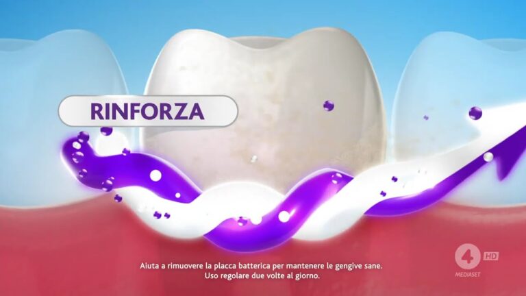 Parodontax: Soluzione per Gengive Infiammate