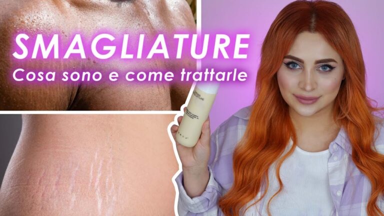 Bio Oil: Soluzione Efficace per le Smagliature Rosse
