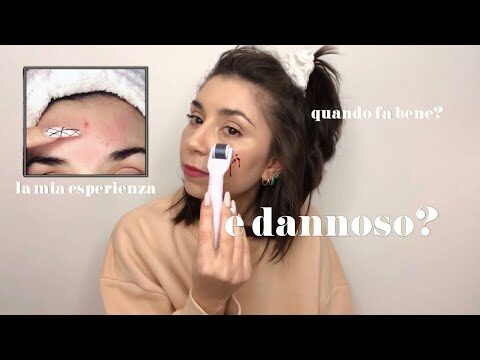Critiche sul Microneedling: Opinioni Negative e Riflessioni