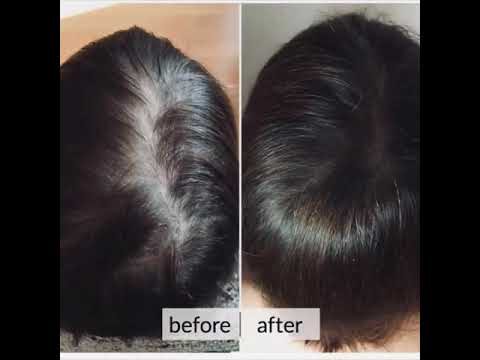 Fitline Hair Plus: Soluzione Innovativa per Capelli Sani e Forti