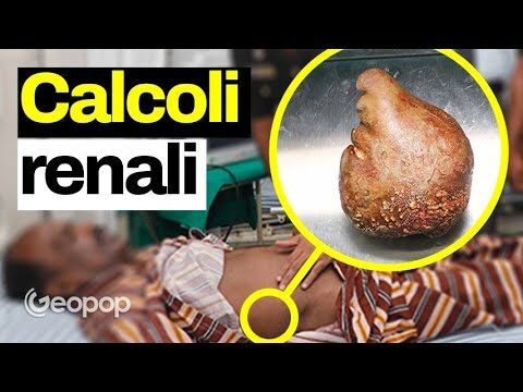 Acqua Uliveto e Calcoli Renali: Benefici e Ricerche